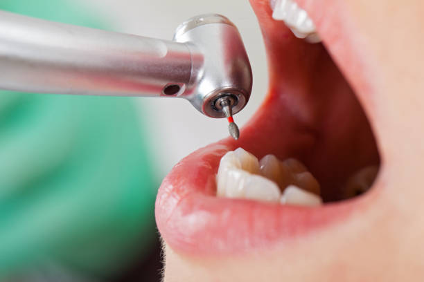 Best Urgent Tooth Repair  in Battlement Mesa, CO